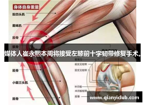 媒体人崔永熙本周将接受左膝前十字韧带修复手术。